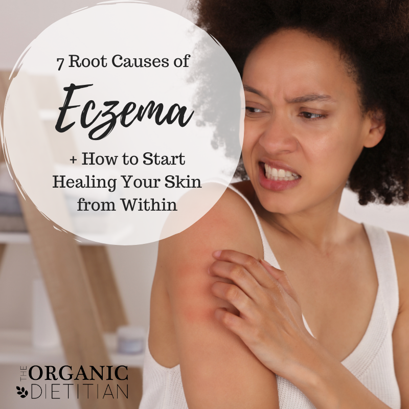 7-root-causes-of-eczema-how-to-start-healing-your-skin-from-within